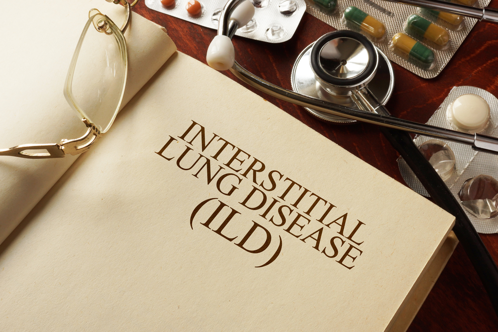What is ILD? Interstitial Lung Disease (ILD) Patient Education